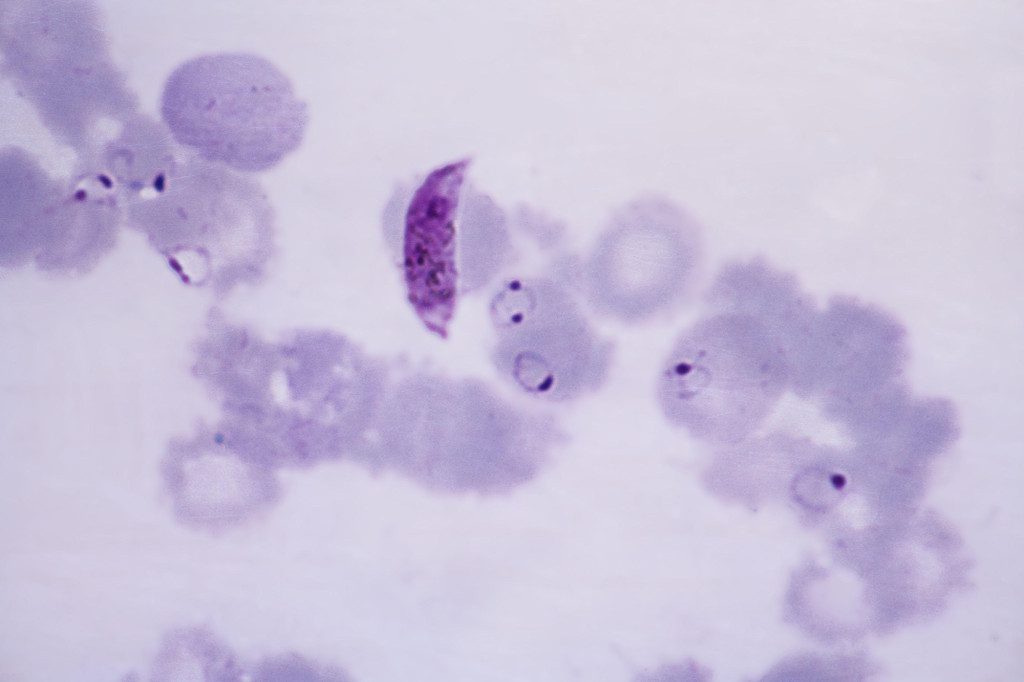 A Small Clinical Trial From NIH Reveals One Dose Of Monoclonal Antibody Might Prevent Malaria For Up To Nine Months