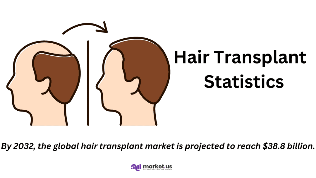 Hair Transplant Statistics